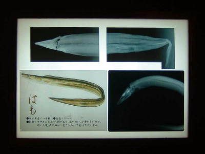 レントゲン写真