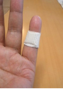 手汗に効果的という口コミ多し ほぼ無料でできる小指シップってなに 手汗 脇汗 そういう悩みのためのブログ