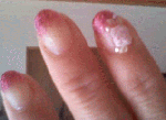 nail