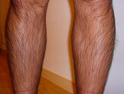 男性の脚の体毛