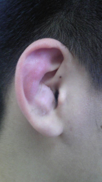 before.jpg