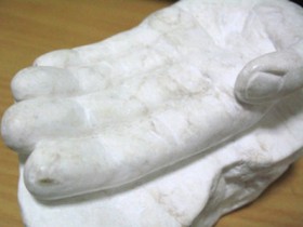 石膏の手
