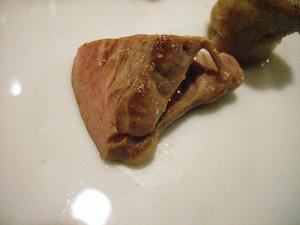 腎臓