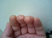 070329after