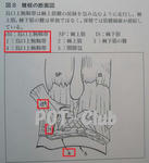 烏口上腕靱帯　断面