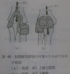 肘関節の関節包