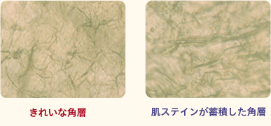 美白コスメが効かないくすみは肌ステインかも