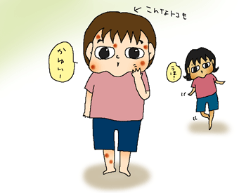 蚊ーーーーーーー！
