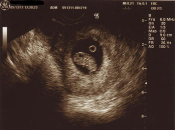 8w4d