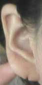 080929ear.jpg