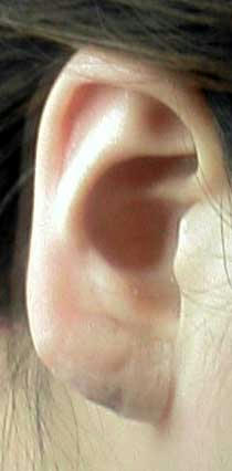 081013ear.jpg