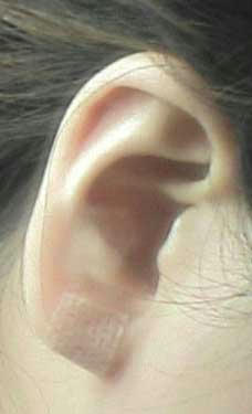 081019ear.jpg