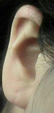 081102ear.jpg