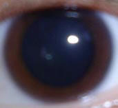 eye.jpg