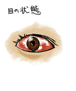 eye00.JPG
