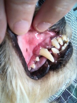 右側　歯