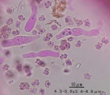 spores.jpg