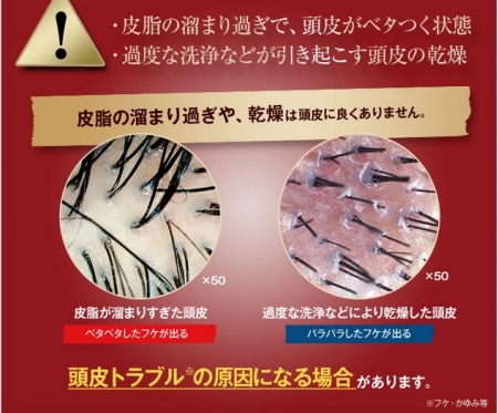 ニキビ 頭皮