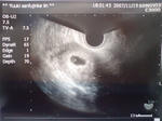 62b4f974.JPG