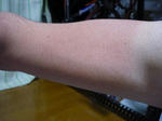suntan.jpg