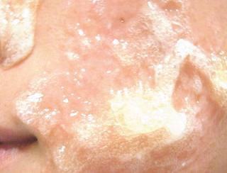 フェヴリナ　ジェルパック　　口コミ