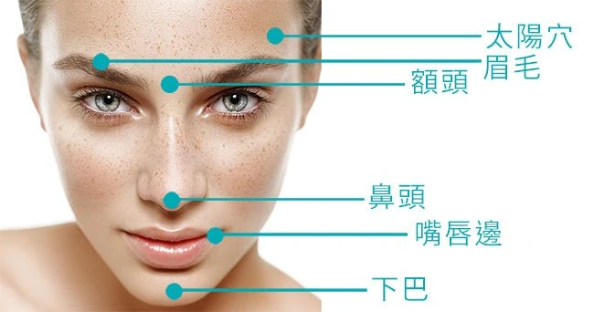 痘痘部位暴露你的病情