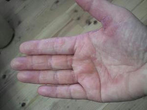 before.JPG