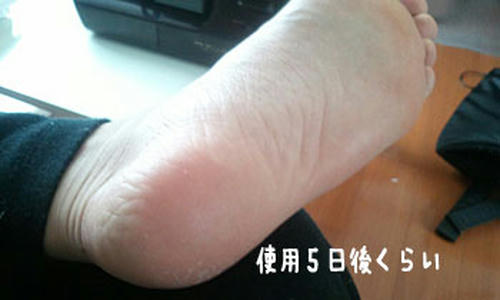 20110630_no2.jpg