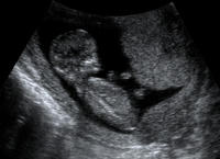 Baby 12w2d