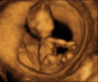 4D Baby 12w2d