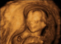 4D Baby 16w4d