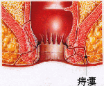 ji4.gif